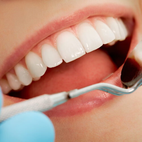 Jakie są skuteczne sposoby na wybielenie zębów?